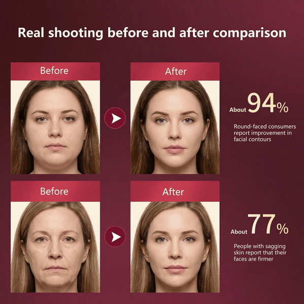 VLine Lift Facial Massager